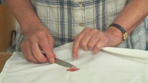 Удаление воскового пятна