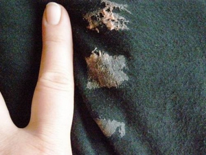 Удаляем жвачку с джинсов