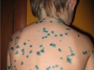 Способы удаления загрязнений на детской коже