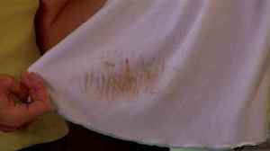 Гидросульфид может помочь при удалении таких неприятных ржавых пятен на одежде.