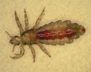 Как уничтожить платяных вшей