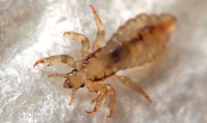 Куда кусают вши человеку