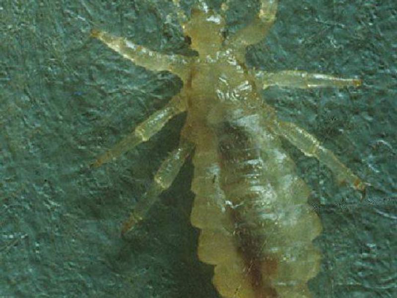 Чем уничтожить вшей