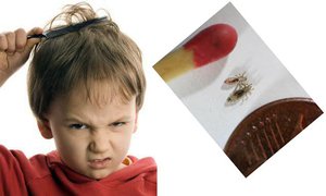 Лечение вшей в домашних условиях