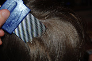 Как вычесать вшей