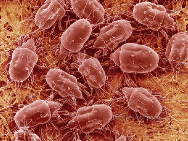 Сколько живут пылевые клещи